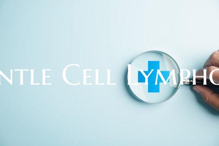 Mantle Cell Lymphoma